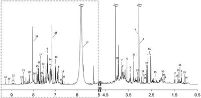 Differential Metabolites in Chinese Autistic Children: A Multi-Center Study Based on Urinary 1H-NMR Metabolomics Analysis